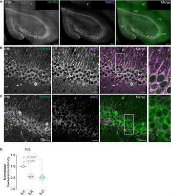 TRPM4 Expression During Postnatal Developmental of Mouse CA1 Pyramidal Neurons